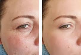 anti aging skincare ingredients